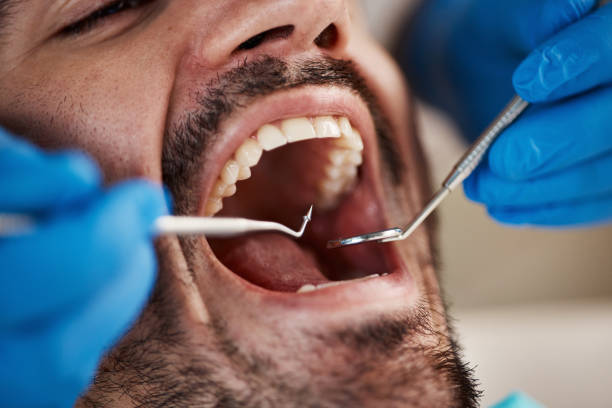 Best Pediatric Emergency Dentist in Metamora, IL